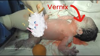 Do you know anything about the vernix layer of newborns [upl. by Crofoot628]