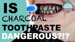 Is Charcoal Toothpaste Dangerous  Review of Different Charcoal Products [upl. by Aram]