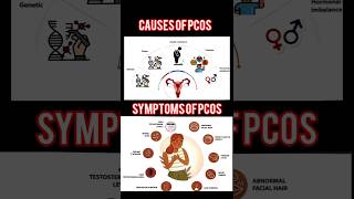 Polycystic Ovarian Syndromepcos pcod pcodtreatment pcosawareness pcosinfertility pcoslifestyle [upl. by Broddie]