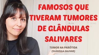 Famosos que tiveram tumores em glândulas salivares tumor na parótida [upl. by O'Meara]