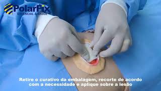 Aplicação Wound Care A  Curativo de Alginato de Cálcio Estéril  Polar Fix [upl. by Kursh22]