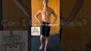 Can I fix scoliosis What was my question when I looked for professional support at the age of 16 [upl. by Asserac]