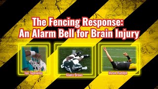 The Fencing Response An Alarm Bell for Brain Injury [upl. by Sonitnatsok592]