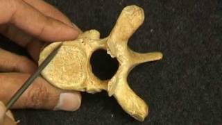 Osteology VivaVertebrae by Ghanashyam Vaidya [upl. by Faydra]