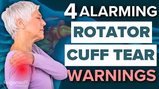 4 Alarming Signs Youre Ignoring a Rotator Cuff Tear  Regenexx Pittsburgh [upl. by Aselehc]