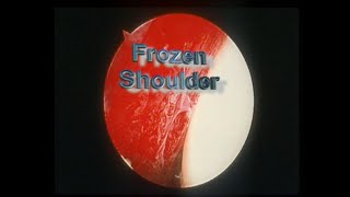 Frozen Shoulder  GeorgeMurrellShoulders [upl. by Milak]