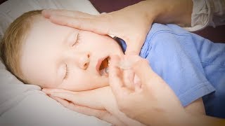 How to Give Your Child Buccal Midazolam [upl. by Irrak]