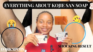 HOW TO EFFECTIVELY USE KOJIE SAN SOAP  Kojie San Soap Detailed Review [upl. by Ocko508]