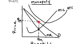 Monopoly Economic Loss Graph [upl. by Eiramik477]