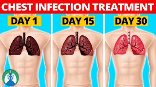 7 Natural Chest Infection Treatments Home Remedies [upl. by Mohammed726]