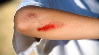 How to Treat Cuts amp Scrapes  First Aid Training [upl. by Loredo]