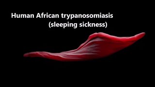 Human African Trypanosomiasis sleepingsickness Trypanosomiasis WHO [upl. by Atinel771]