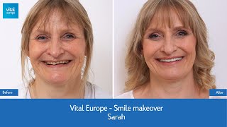 VitalEurope  Smile makeover  Sarah [upl. by Ilrebma]