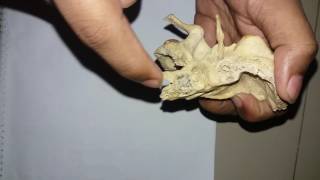 Temporal bone Part2Bangla tutorial [upl. by Aziza]