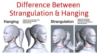 Difference Between Hanging and Strangulation [upl. by Enyak]