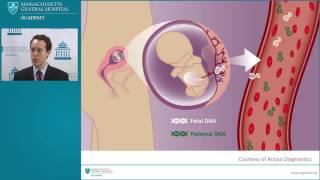 Prenatal Diagnosis of Down Syndrome Delivering Results in our New Age of Genetic Testing [upl. by Leckie]