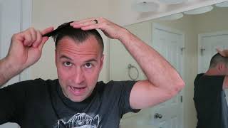 How to Fix Your Hair Pompadour Undercut with Receding Hairline [upl. by Albric325]