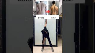 Fix your posture  scoliosis posture posturecorrection scoliosis reels shorts [upl. by Kristopher]