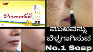 Dermadew Liite Soap Review In KannadaSkin whiteningRemove PigmentationGlowing skin [upl. by Minetta]