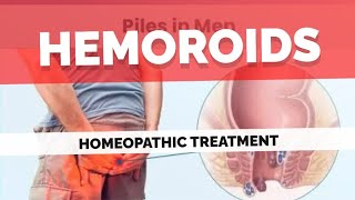 Piles Problem treatment  hemoroids  hemoroids treatment at home naturally  piles homeopathic [upl. by Flannery]