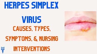 HERPES SIMPLEX VIRUS Nursing Interventions Causes amp Types [upl. by Llehcal664]