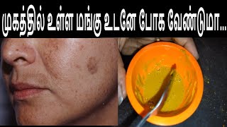 முகத்தில் உள்ள மங்கு உடனே போக வேண்டுமாMangu KaruppuMelasmaPigmentation [upl. by Annahc]