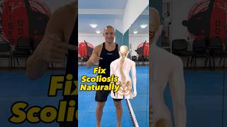 Fix scoliosis naturally scoliosis backpain back yoga training lesson exercise [upl. by Susana]