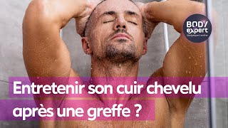 GREFFE DE CHEVEUX TURQUIE  👨🏻‍🦱 Entretenir son cuir chevelu après une greffe  Partie 1 BODYEXPERT [upl. by Boeke444]