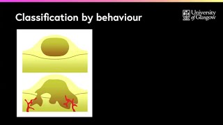 What are the differences between benign amp malignant tumours [upl. by Thier]