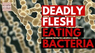 The Disturbing Truth About FleshEating Bacteria MUST WATCH [upl. by Vasily]