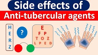 Side effects of AntiTubercular agents in easy way [upl. by Rasia]