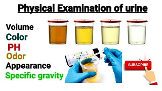 Physical Examination of urine part 2  PH and Specific gravity of urine [upl. by Analat]