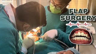 Periodontal FLAP SURGERY with GTR in NOBEL MEDICAL COLLEGE TEACHING HOSPITAL BIRATNAGAR [upl. by Davina]