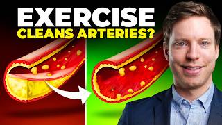 This Exercise Clears Plaque in Your Arteries New Trial [upl. by Rayner304]