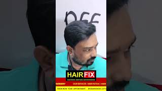 Bhubaneswar  70089 17701  hairpatchcost hairpatchcost [upl. by Hosfmann]