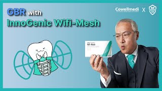 The surgery of Digital implant solution and GBR using nonresorbable membrane WiFiMesh [upl. by Hayne]