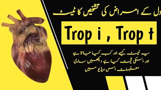 Troponin Enzymes Test in Urdu  Trop i Test  Best Test To Confirm Heart Attack [upl. by Michiko]