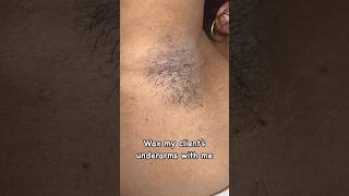 Underarm Waxing 🥰 esthetician underarmwax waxing watchthis shortsvideo [upl. by Yregram695]