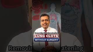 Removing lifethreatening lung clots without surgery  Pulmonary Embolism  Non surgical treatment [upl. by Olyhs27]