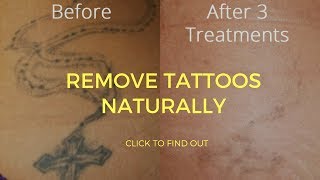 How To Remove Tattoos Naturally [upl. by Hnad]