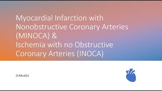 Myocardial Infarction with Nonobstructive Coronary Arteries MINOCA amp INOCA [upl. by Lotti]