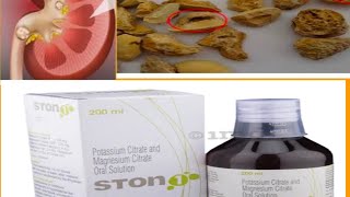 Ston 1 Potassium Citrate Magnesium Citrate Kidney ki pathari ki dawa Kidney Stone [upl. by Culbert751]