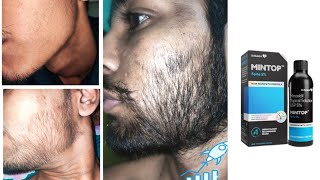 mintop minoxidil 5 beard  minoxidil beard growth  how to grow beard derma roller for beard growth [upl. by Zondra292]