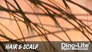 DinoLite Applications Hair and Scalp [upl. by Kohcztiy]