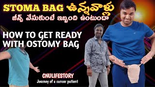 Stoma Bag తో ప్రయాణం చేయొచ్చా Bag మీదనుండి నుండి బట్టలు వేసుకుంటే నొప్పి ఉంటదా  Stoma Bag Life [upl. by Reste]