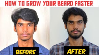 GROW YOUR BEARD FASTER NATURALLY AT HOME  BEARD GROWTH TIPS IN TAMIL [upl. by Cathey549]