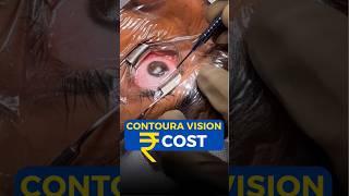 Contoura Vision Cost [upl. by Undry]