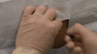 Lumbar puncture2mp4 [upl. by Jos]