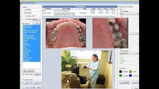 Dental Procedure Codes  Misused and Underused Codes 2018 [upl. by Benoit639]