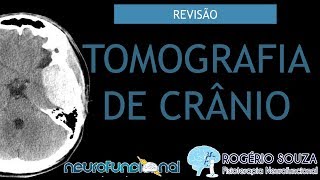 TOMOGRAFIA DE CRÂNIO Vídeo Aula  Rogério Souza [upl. by Lillian]